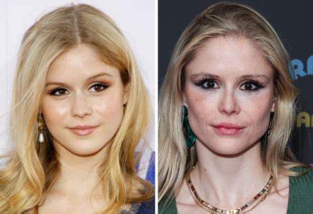 Erin Moriarty Before and After Plastic Surgery Journey。